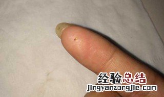 跳蚤怕啥? 跳蚤怕什么东西或者味道