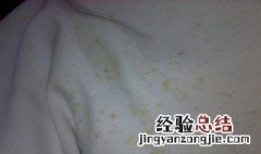 湿床单发霉怎么才能清洗干净 湿床单发霉如何才能清洗干净