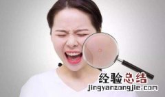 过期的食品吃了怎么办 吃过期的食品起痘痘怎么办