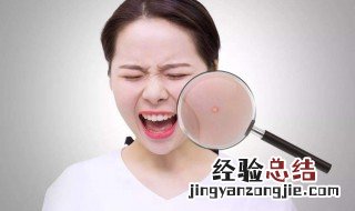 过期的食品吃了怎么办 吃过期的食品起痘痘怎么办