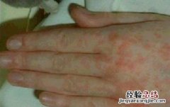 传染病及其预防 传染病及其预防思维导图