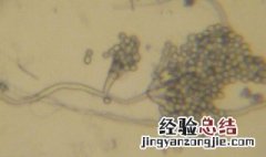 青霉菌的形态结构 青霉菌的形态结构介绍