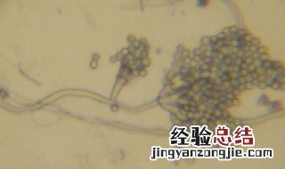 青霉菌的形态结构 青霉菌的形态结构介绍