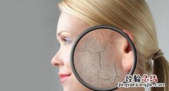 什么是过敏性皮肤 什么是过敏性皮肤指点