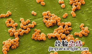 金黄色葡萄球菌是什么原因引起的 金黄色葡萄球菌是什么