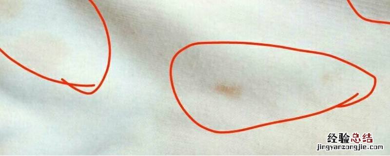 白裙子的黄色污渍 白色裙子上有黄色污渍怎么洗掉