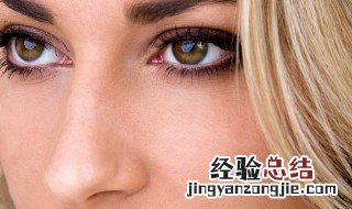 眼部干纹怎么祛除 眼部干纹怎么去除