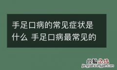 手足口病的常见症状是什么 手足口病最常见的症状是什么