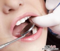 牙齿神经痛吃什么药最管用 牙齿神经痛