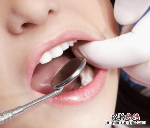 牙齿神经痛吃什么药最管用 牙齿神经痛