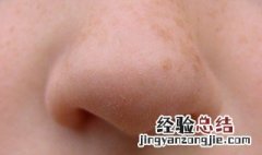 粉刺最好的消除方法 粉刺最好的消除方法图片