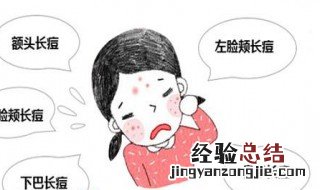 痤疮和青春痘的区别 痤疮和青春痘的区别是什么