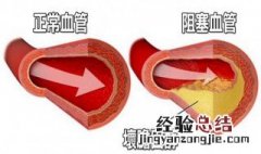 胆固醇高的原因和危害 下面有详细介绍