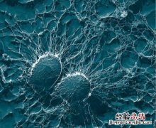 金黄色葡萄球菌 金黄色葡萄球菌首选抗生素