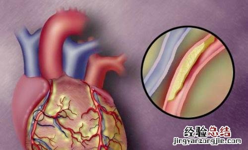 甘油三脂偏高的原因是什么意思 甘油三脂偏高的原因是什么