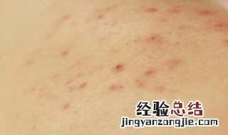 皮肤各部位出现小痘痘是怎么回事啊 皮肤各部位出现小痘痘是怎么回事