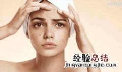 长痘痘用什么身体乳好一点 长痘痘用什么身体乳好