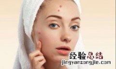换季长痘痘是什么原因 换季会长痘痘