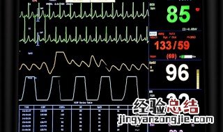 cad中半径标注设置 其实很简单