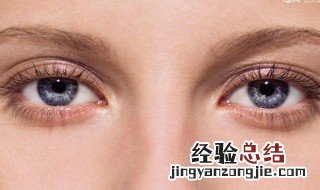 下眼袋是如何形成的 下眼袋怎么形成的原因