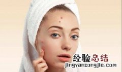 内分泌紊乱长痘痘怎么办 内分泌紊乱长痘怎么办?怎么调理