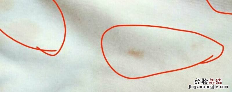 衣服上有黄点怎么清洗 衣服上有黄点怎么洗掉