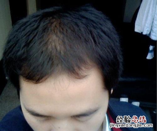 脱发用什么洗发水 脱发用什么洗发水可以重新长头发