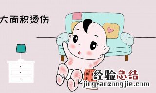 被开水烫起泡了该怎么办 被开水烫了起泡怎么办