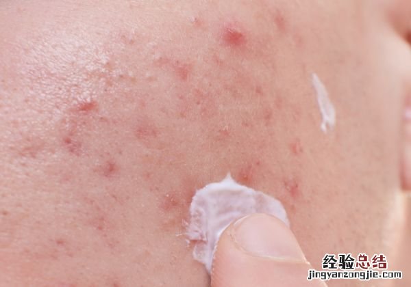 海藻面膜的禁忌有哪些海藻面膜要注意什么