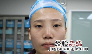 内双用窄的还是宽的双眼皮贴 内双用窄的还是宽的双眼皮贴效果好