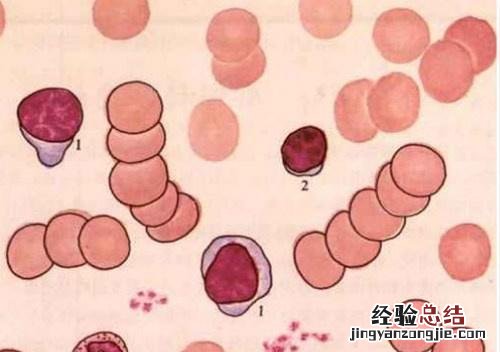 球蛋白高是怎么回事 球蛋白偏低是怎么回事