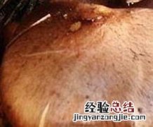 红蘑的功效与作用 红蘑的药用价值