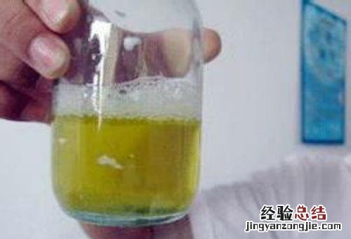 尿蛋白弱阳性是咋回事 尿蛋白弱阳性是什么情况
