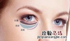 有效去除眼袋的方法 如何有效去除眼袋