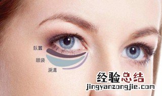 有效去除眼袋的方法 如何有效去除眼袋