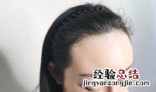 防止发际线后移的方法 如何防止发际线后移
