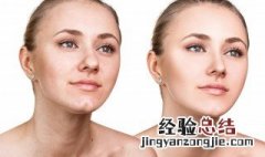 消除粉刺最有效的方法 如何消除粉刺最有效