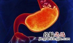 胃酸过多吃什么好 胃酸过多吃什么