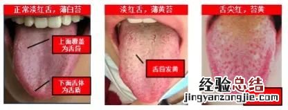 新冠病毒感染者居家使用中成药注意事项