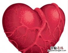 心脏供血不足的症状表现有哪些 心脏供血不足