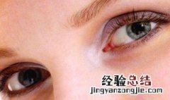 周公解梦右眼皮跳是什么预兆 右眼皮跳是什么预兆