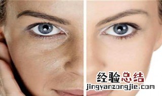 脸部皱纹怎样去除 脸部皱纹怎样去除