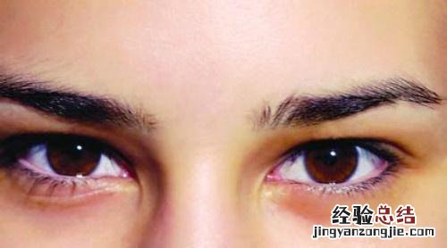 角膜炎严重吗 边缘性角膜炎严重吗