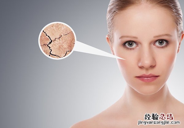 冬季皮肤干燥怎么办 冬季皮肤干燥怎么缓解