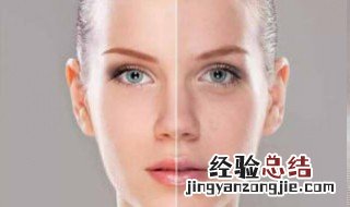 脸上肤色不均匀怎么改善 脸上肤色不均匀是什么原因