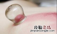 拔火罐的好处和坏处 拔火罐的好处与坏处有哪些？
