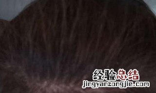 小女孩头发长得慢怎么办 头发长得慢怎么办