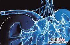 感染性肾结石不能吃什么食物 肾结石不能吃什么食物?