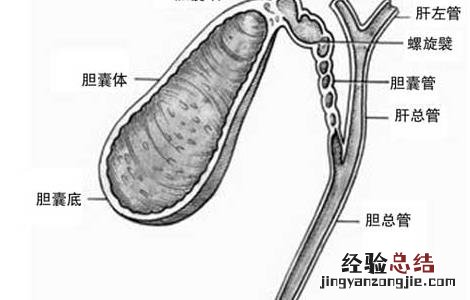 胆结石不能吃什么食物 胆囊炎胆结石不能吃什么食物