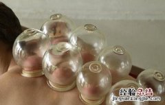 拔火罐的注意事项和禁忌有哪些 拔火罐的注意事项和禁忌